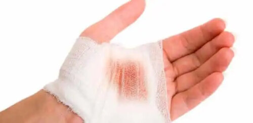 En hand med gasbinda lindad runt ett blödande sår på handflatan.