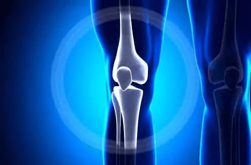 En röntgen av ett knä.