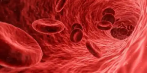 Vad du kanske vill veta om ett aortaaneurysm