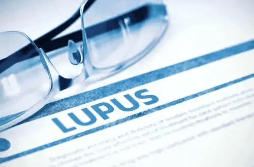 Ordet lupus på ett papper