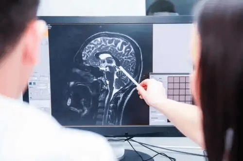 Två läkare studerar en hjärna