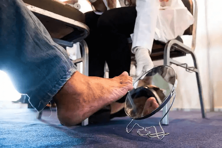 Spegel används för att analysera en brännande känsla i fötterna