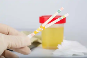 Vad kan urinens pH säga oss?