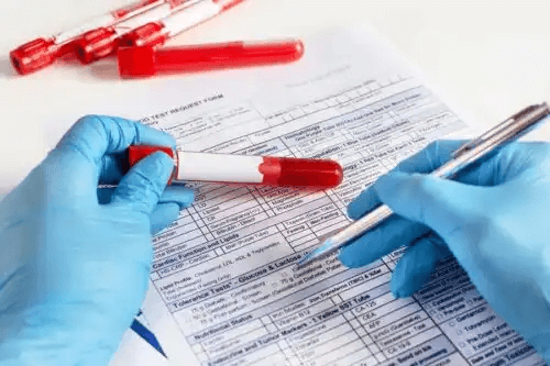 Laboratoriegranskare håller ett blodprov