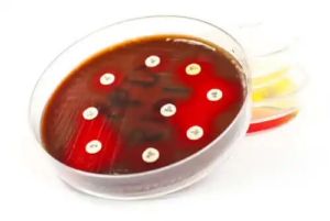 Vad är användningen av ett antibiogram?