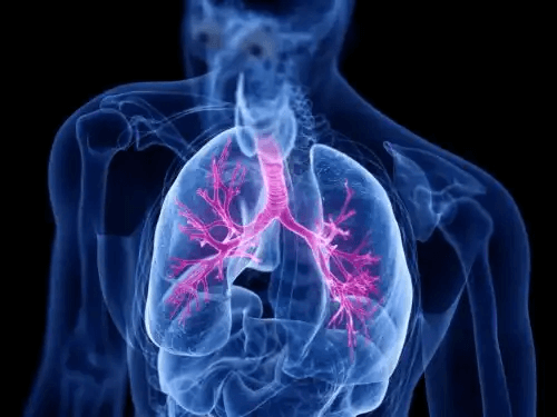 Röntgen av lungor