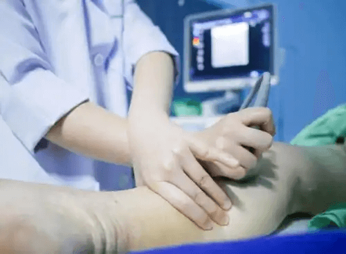 En läkare som masserar ett ben.