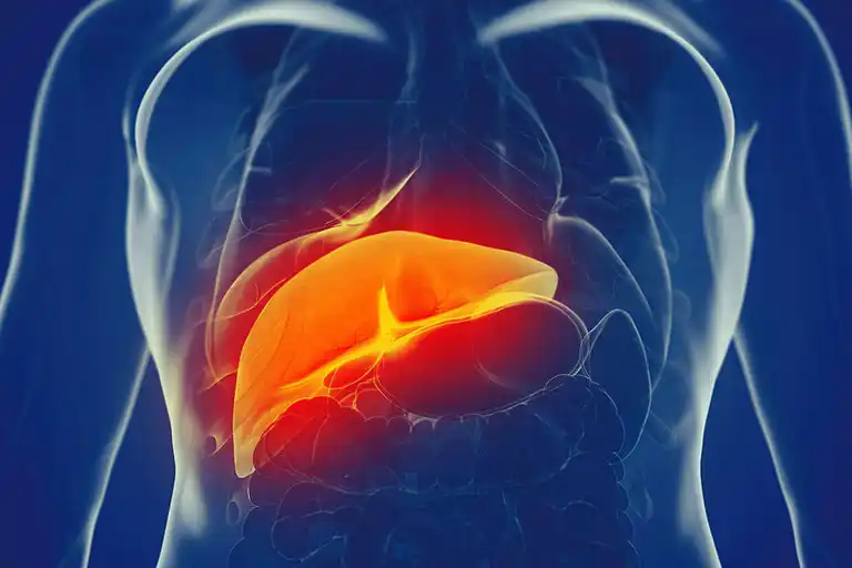 Hepatit ger upphov till inflammation i levern.