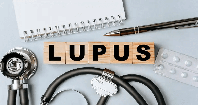 Diagnos av lupus