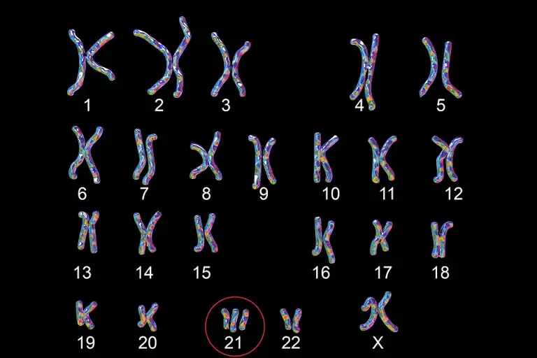 Abnormala kromosomer