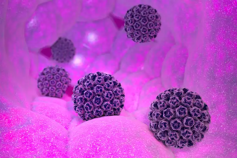 Immunsuppression predisponerar återaktivering av viruset