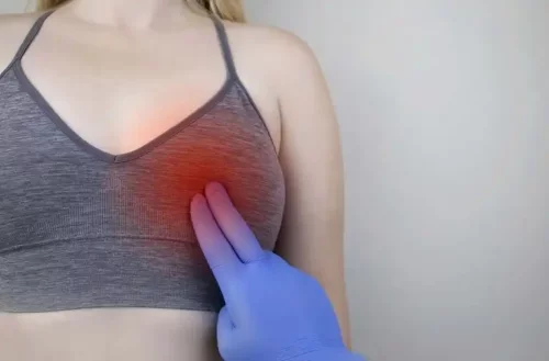 Smärta i bröstet vid mastit