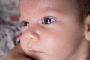 Aniridi eller avsaknad av iris: varför uppstår det?