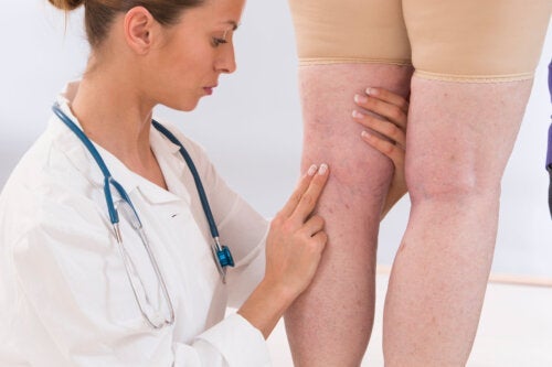 11 symtom på dålig cirkulation i ben och fötter