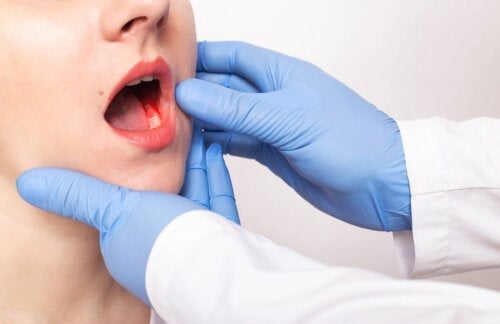 Symtom på parodontit: varför du måste vara uppmärksam