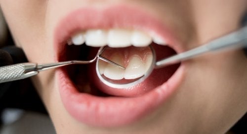 7 konsekvenser av dålig tandhygien för din hälsa
