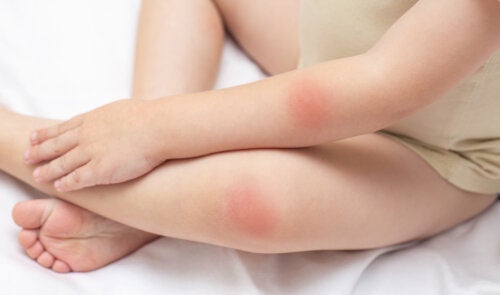 Röda prickar på huden: 25 möjliga orsaker och behandlingar