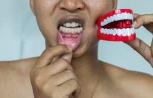 Lila tandkött: orsaker och behandling