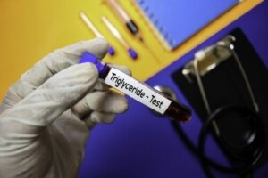 Balansera dina triglyceridnivåer: Hur gör du detta?