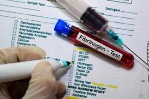 Fibrinogen i kroppen: hjälper blodet att koagulera