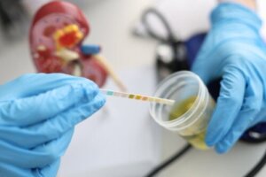 Asymtomatisk bakteriuri: ett oftast ofarligt tillstånd
