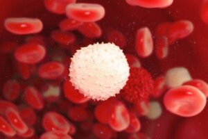 Waldenströms makroglobulinemi: en sällsynt cancerform
